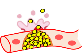 血管3